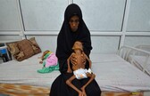 yemen-cocuklar_3240.jpg